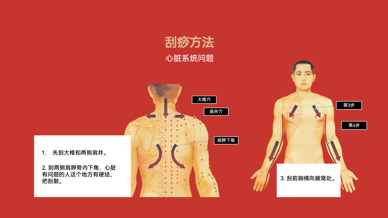 刮痧08.png
