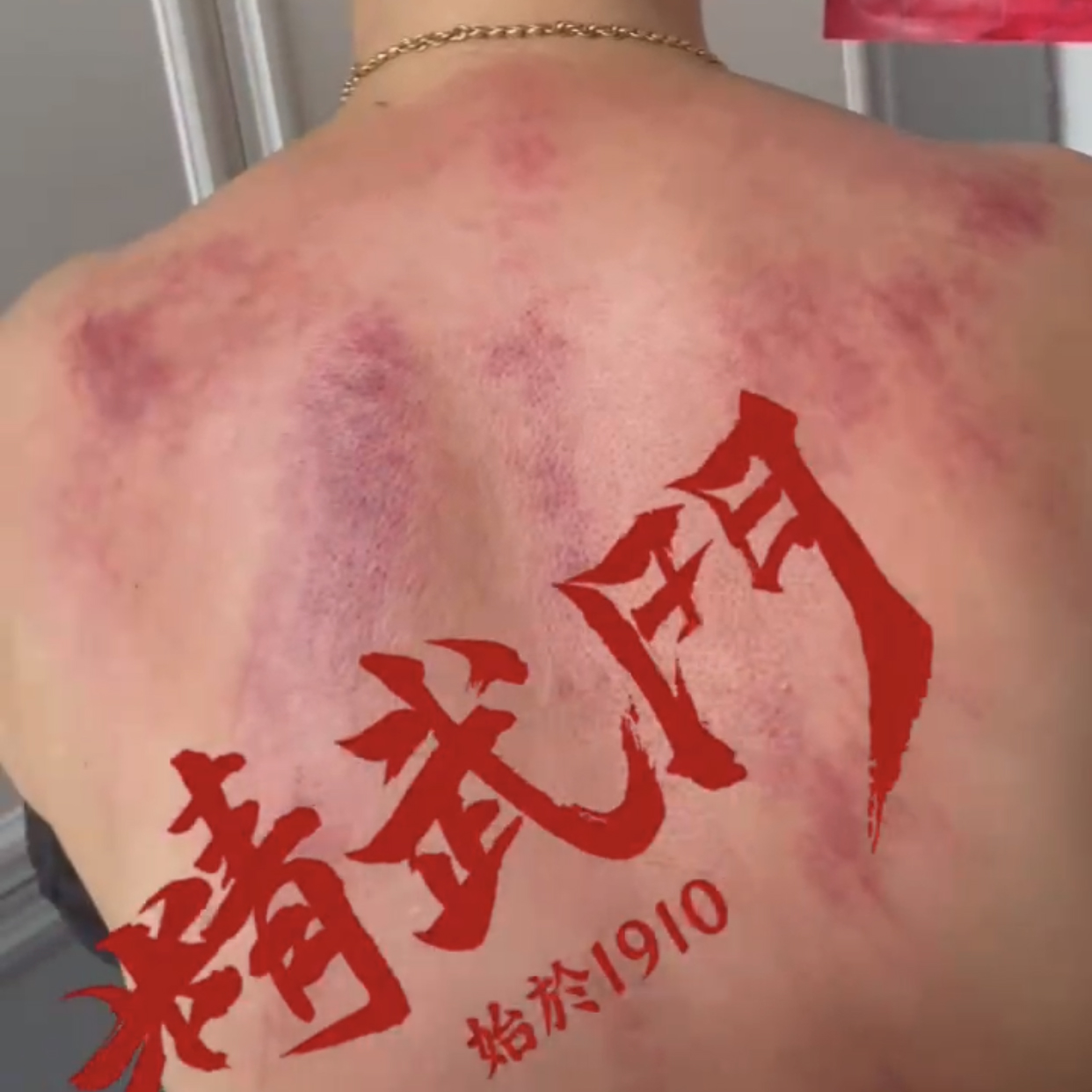 精武门黑老虎油使用案例