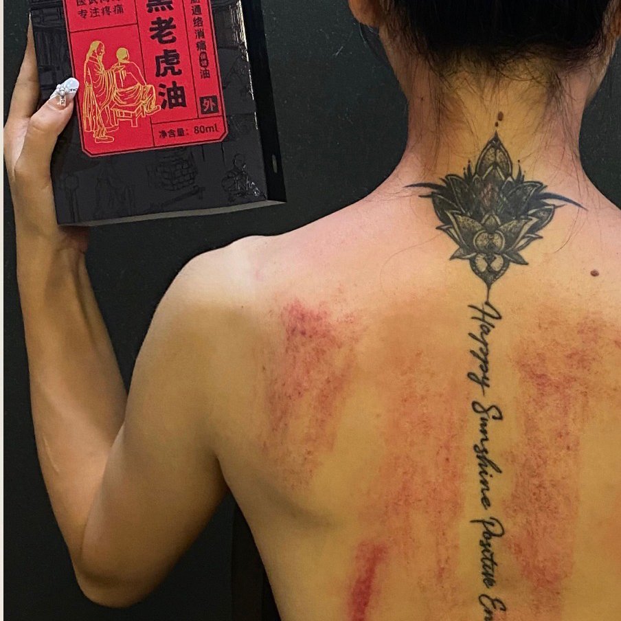 精武门黑老虎膏使用案例