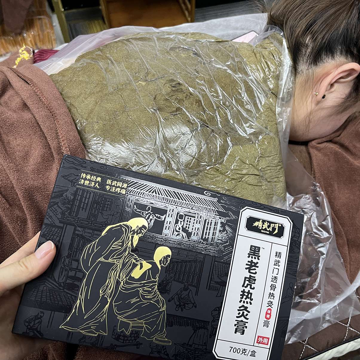精武门热灸膏使用案例