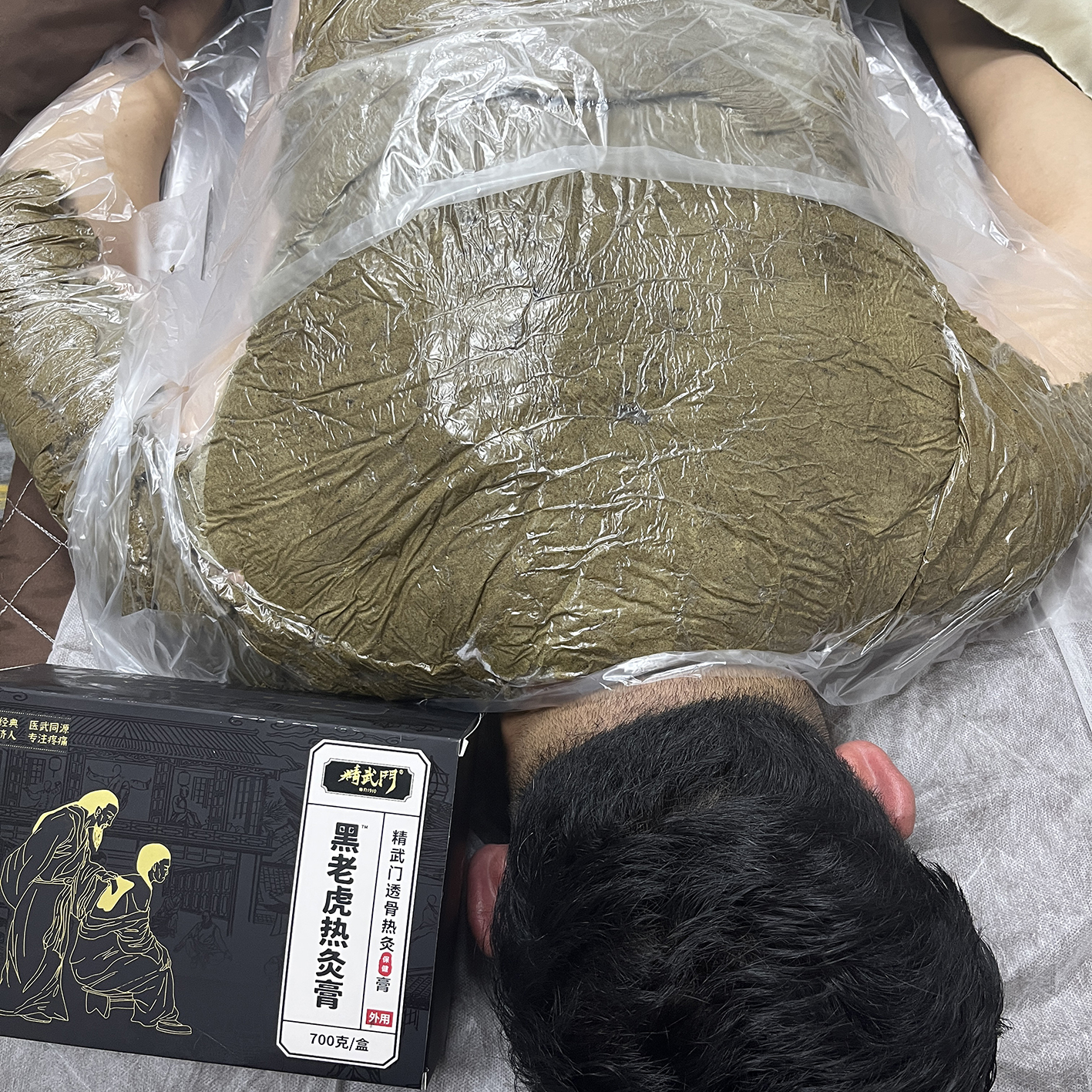 精武门热灸膏使用案例