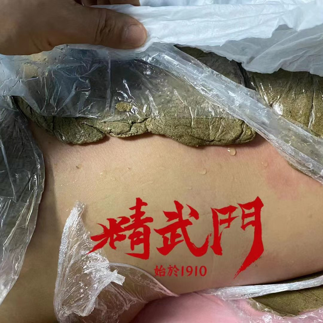 精武门热灸膏使用案例