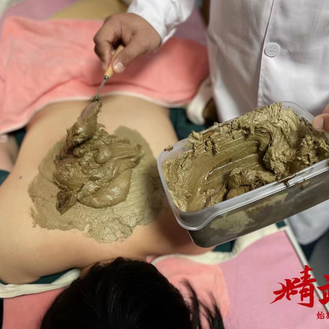 精武门热灸膏使用案例