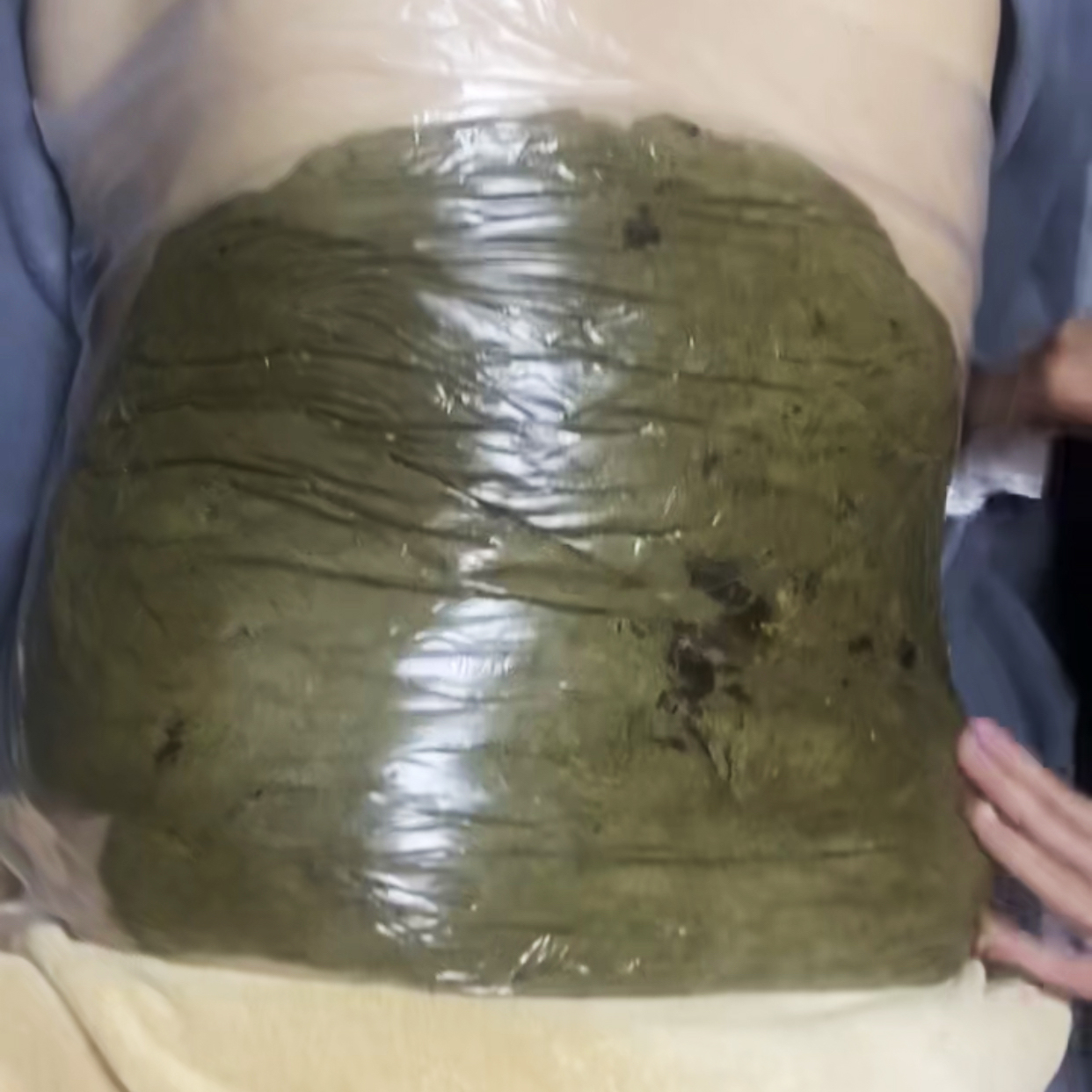 精武门热灸膏使用案例