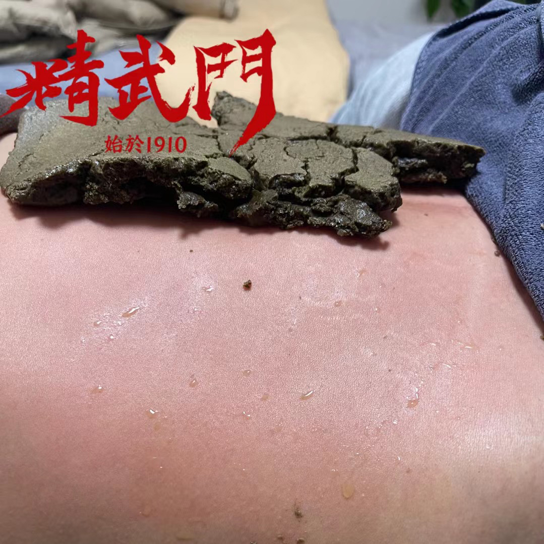 精武门热灸膏使用案例