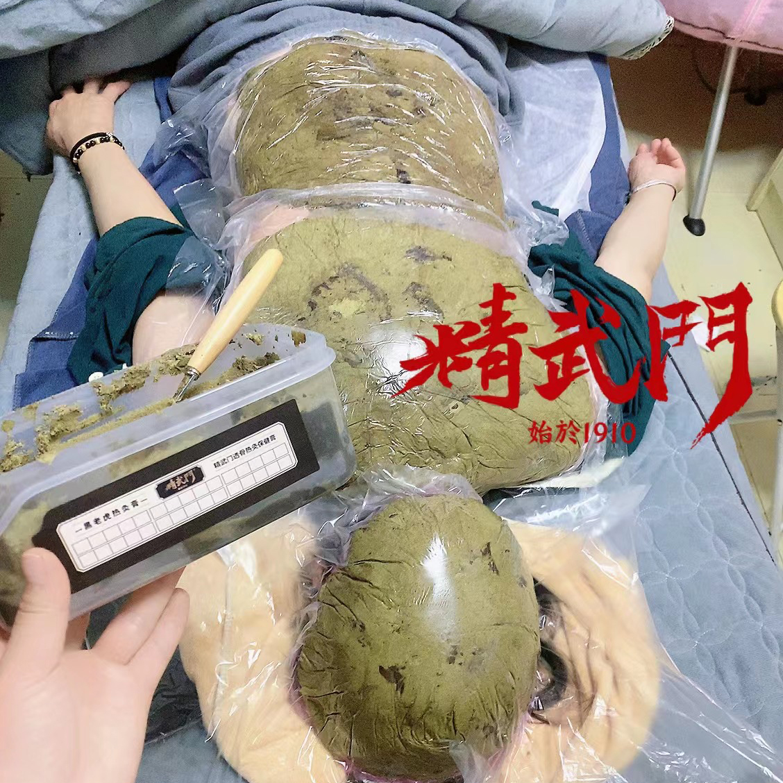 精武门热灸膏使用案例