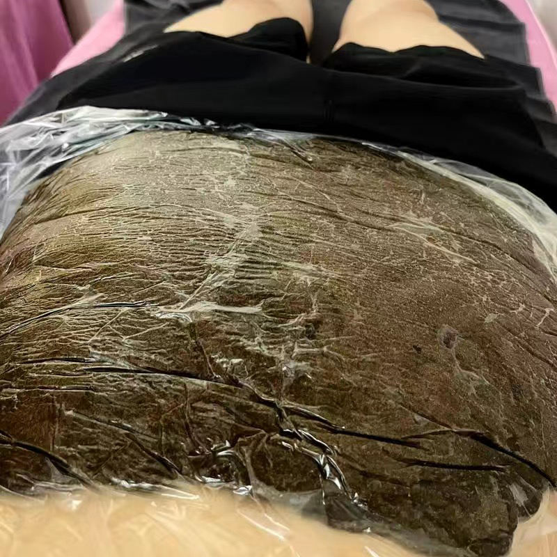 精武门热灸膏使用案例