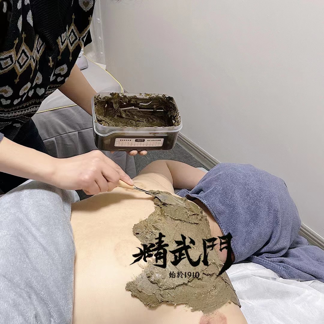 精武门热灸膏使用案例