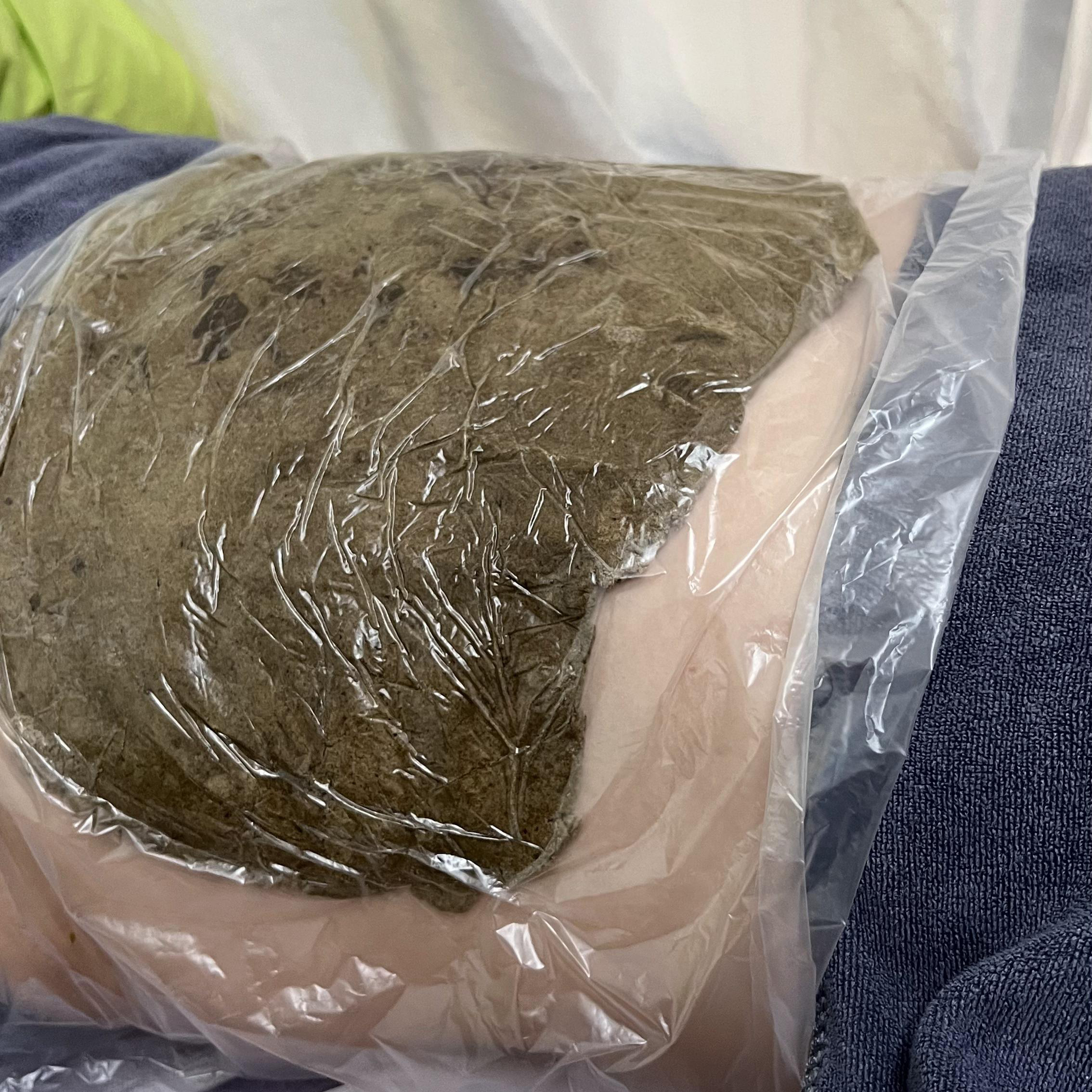 精武门热灸膏使用案例