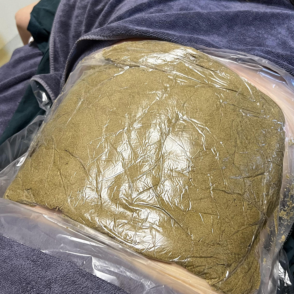 精武门热灸膏使用案例