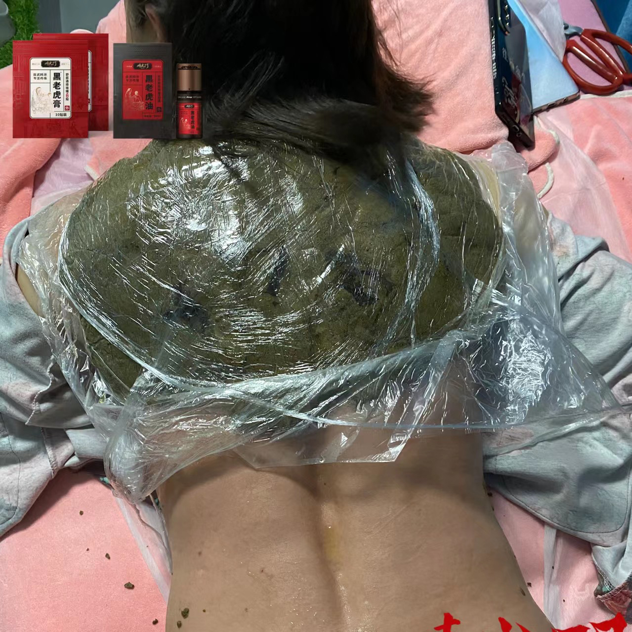 精武门热灸膏使用案例