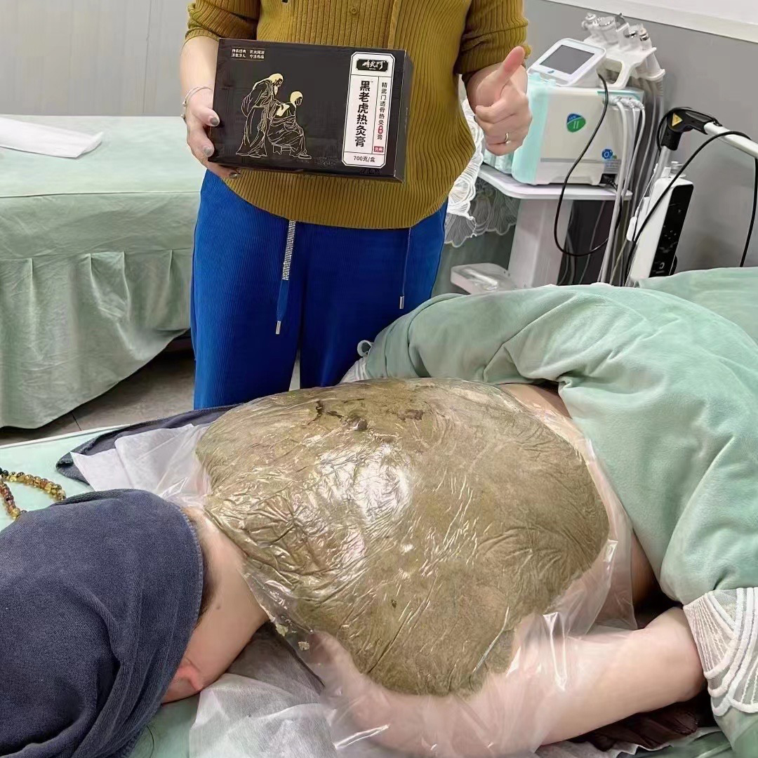 精武门热灸膏使用案例