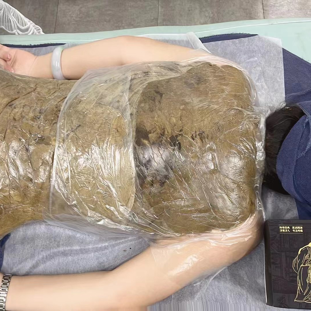 精武门热灸膏使用案例