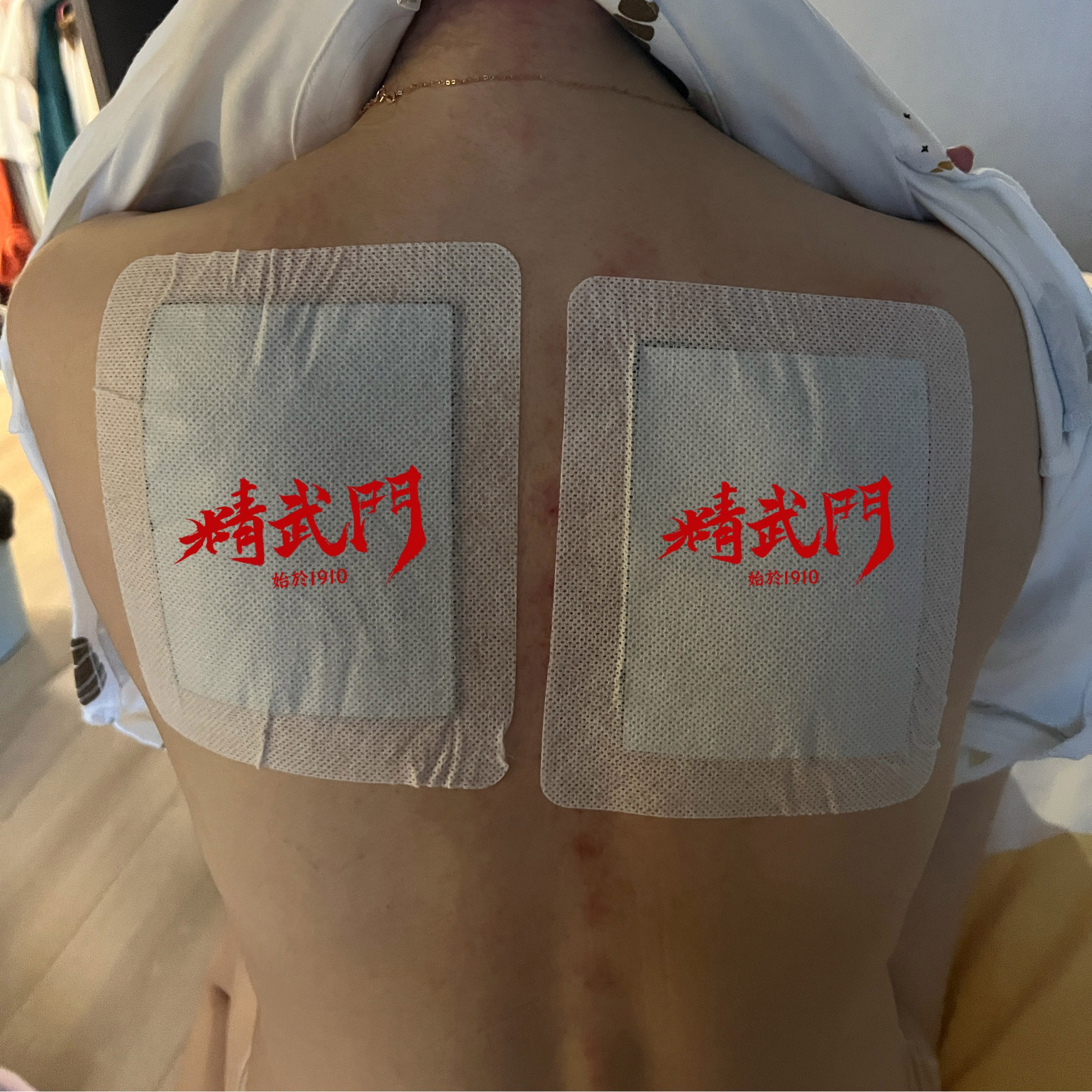 精武门黑老虎膏使用案例