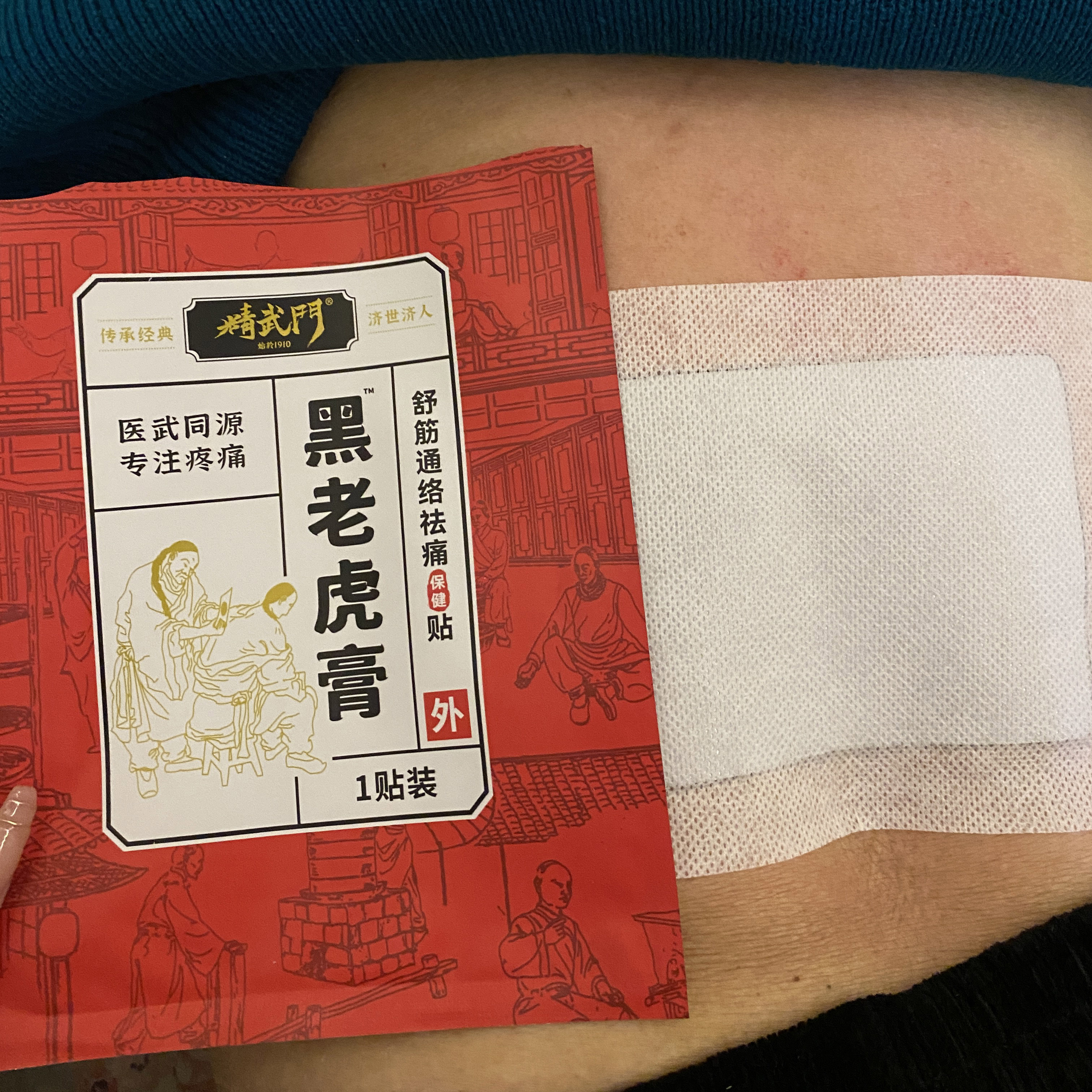 精武门黑老虎膏使用案例