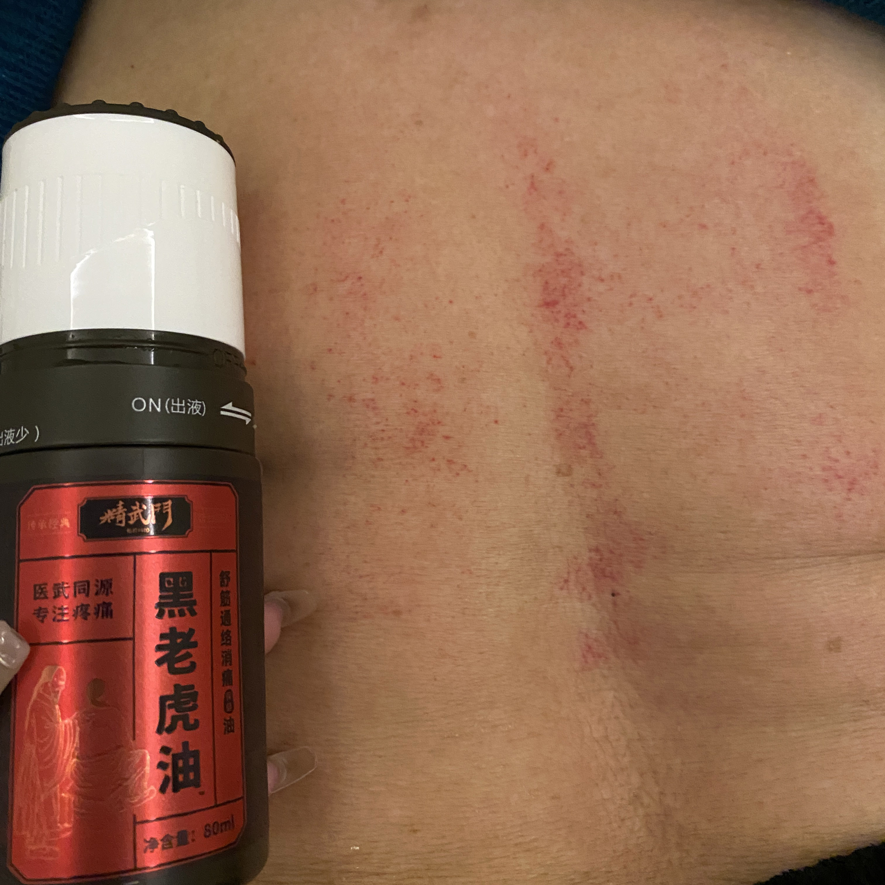 精武门黑老虎油使用案例