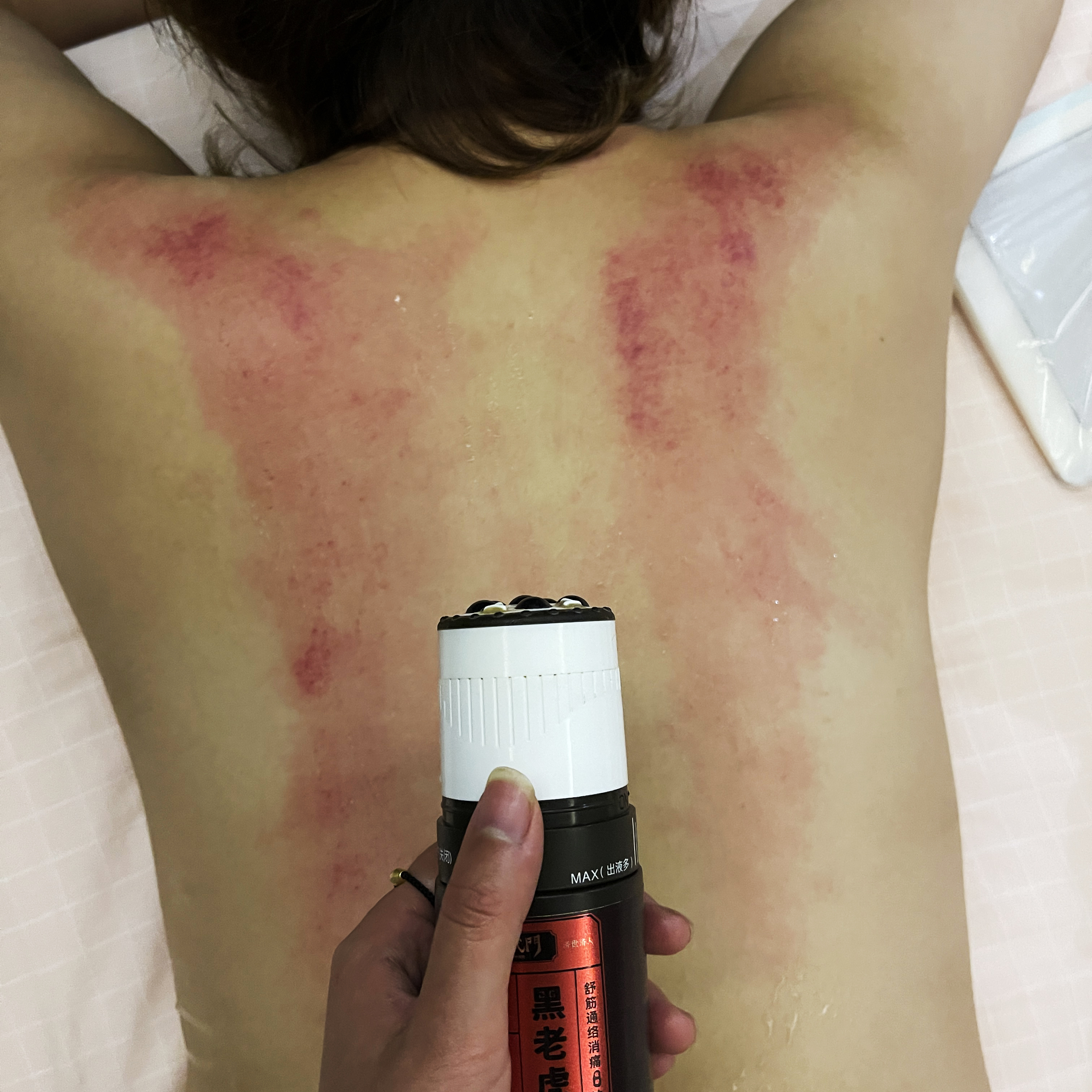 精武门黑老虎油使用案例