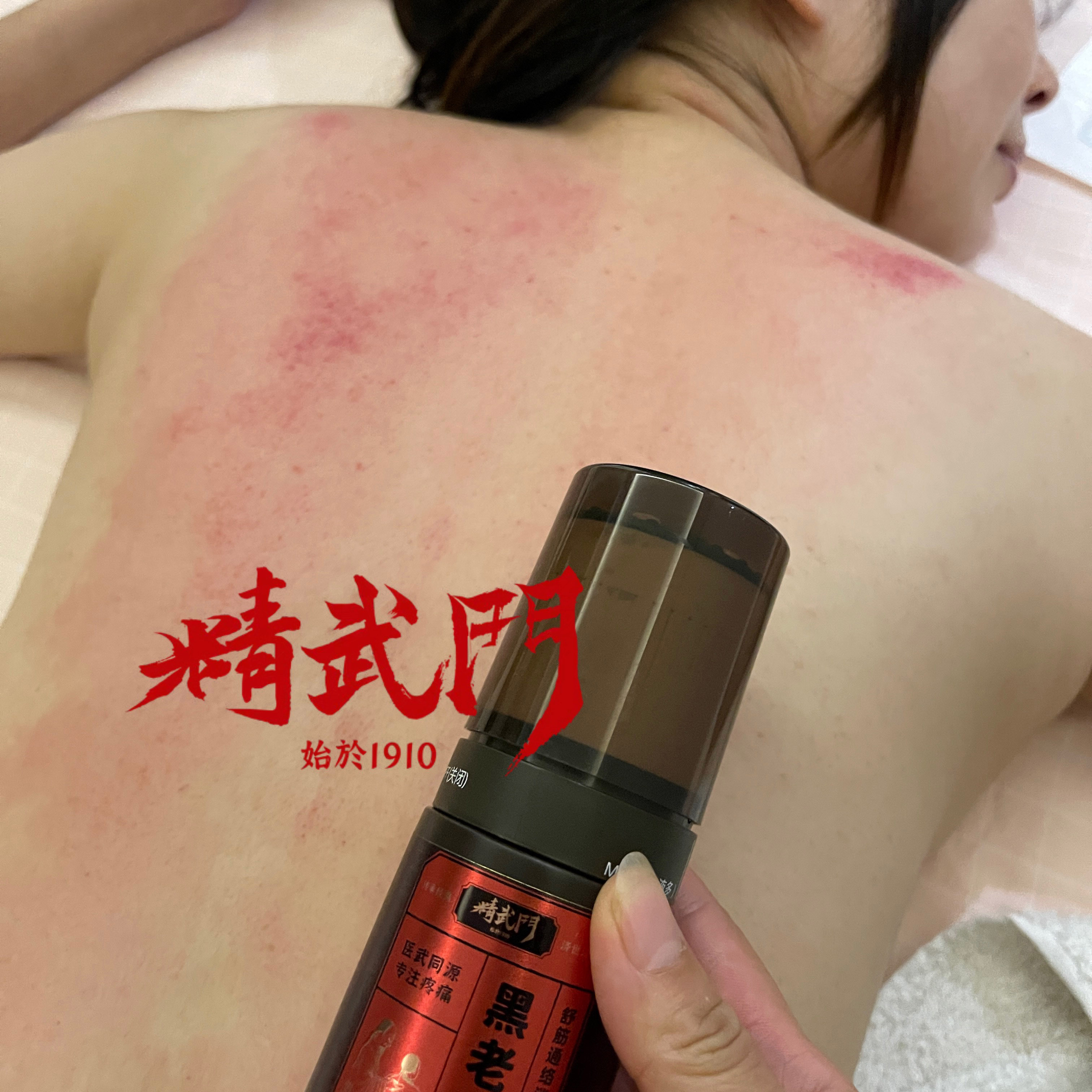 精武门黑老虎油使用案例