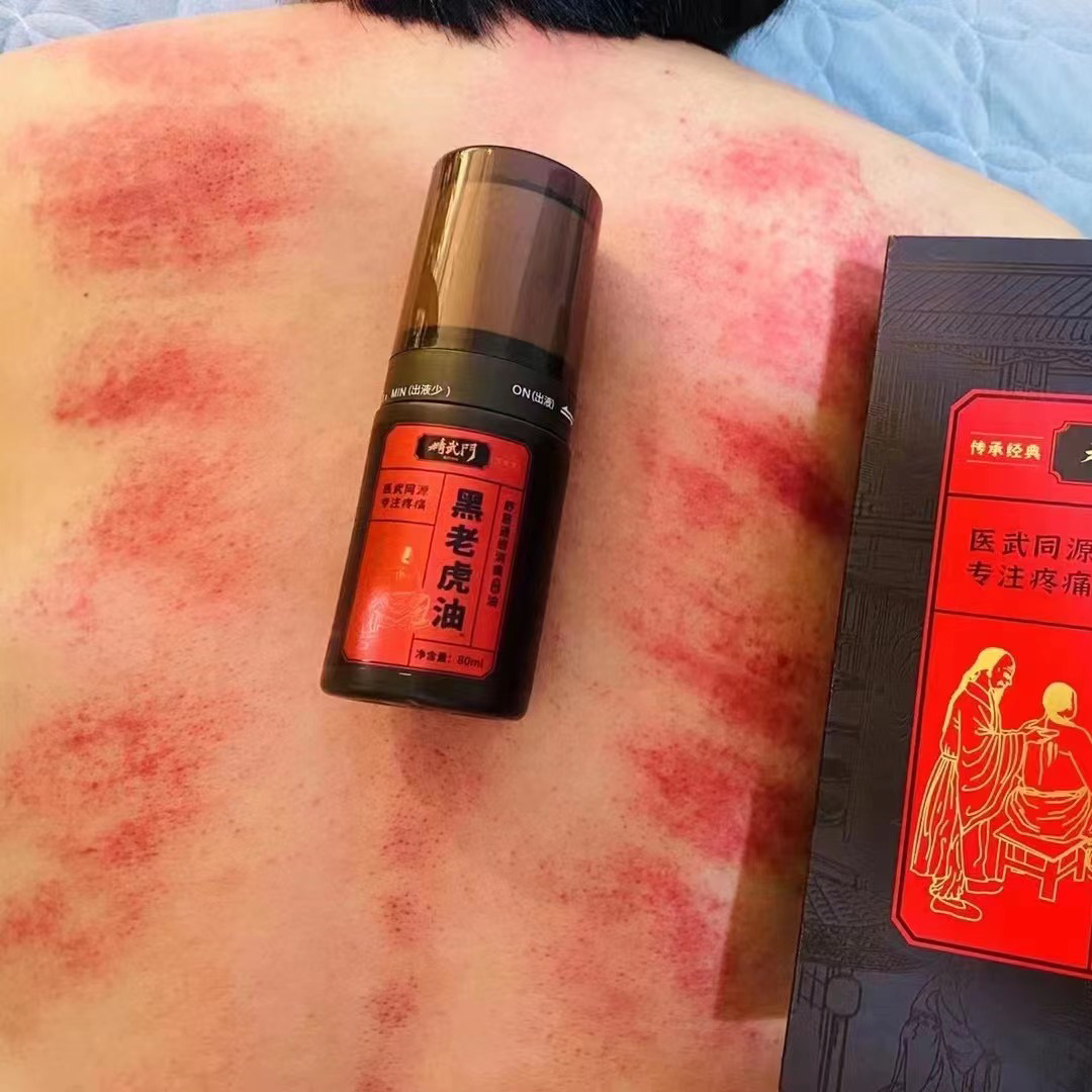 精武门黑老虎油使用案例