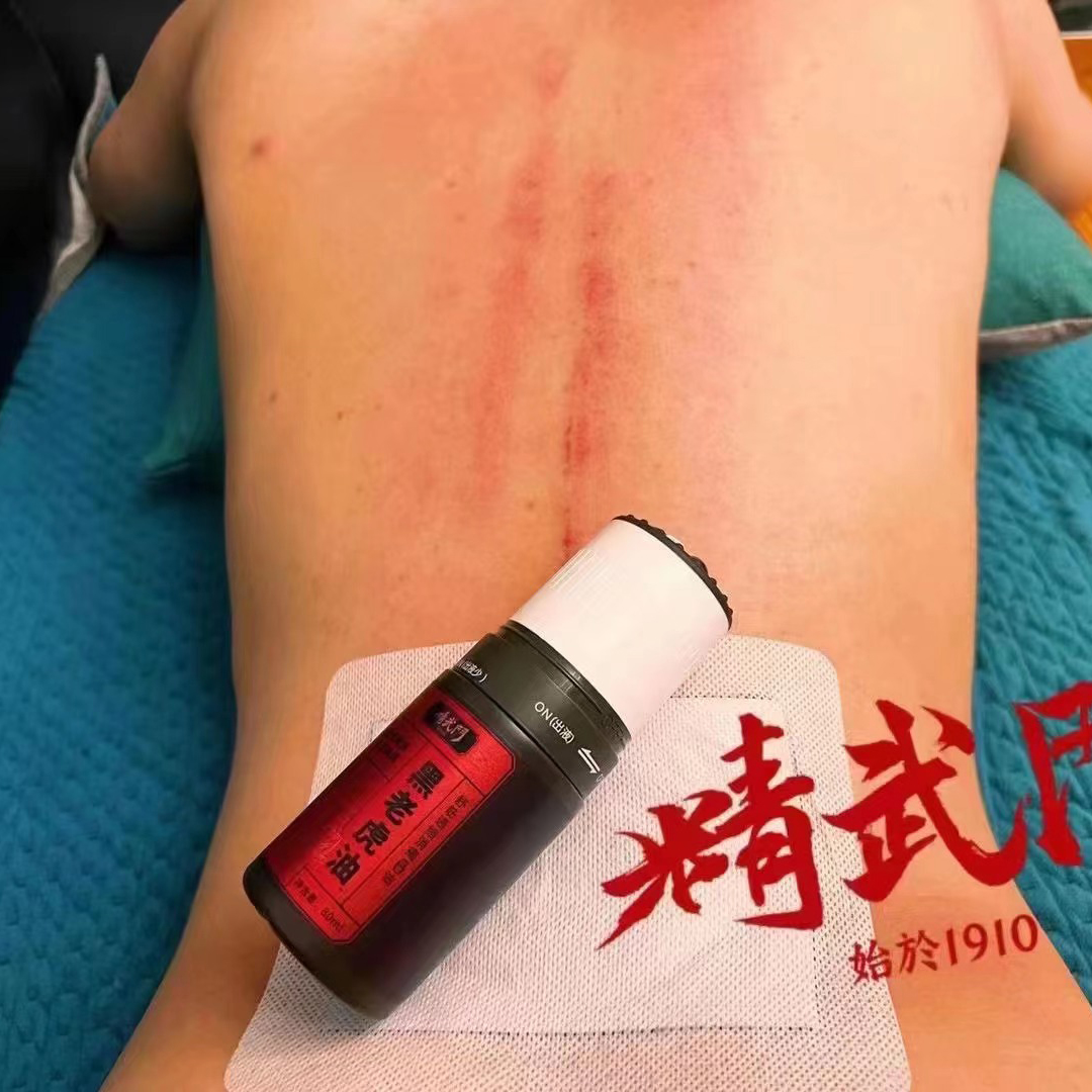 精武门黑老虎油使用案例