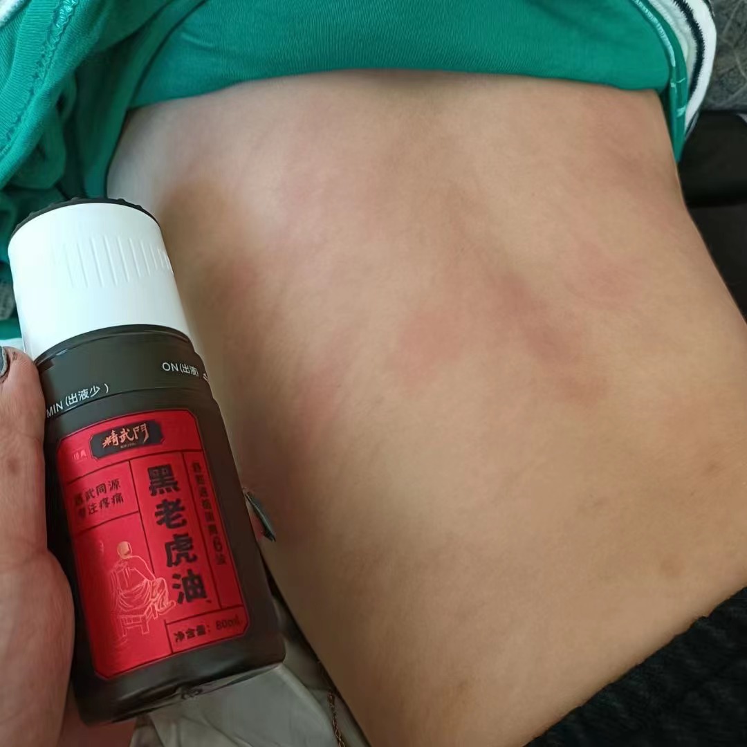 精武门黑老虎油使用案例