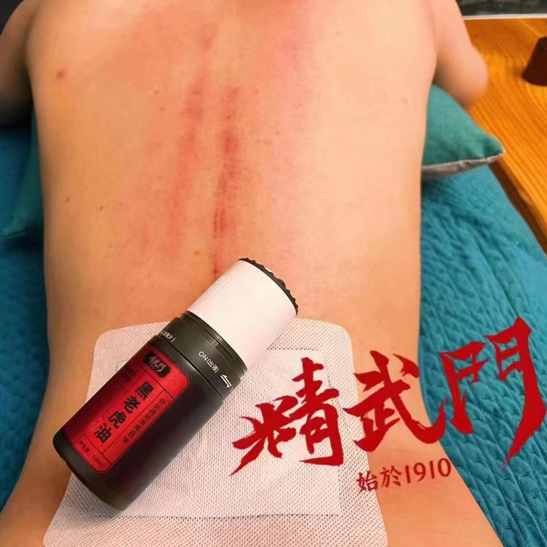 精武门黑老虎油使用案例