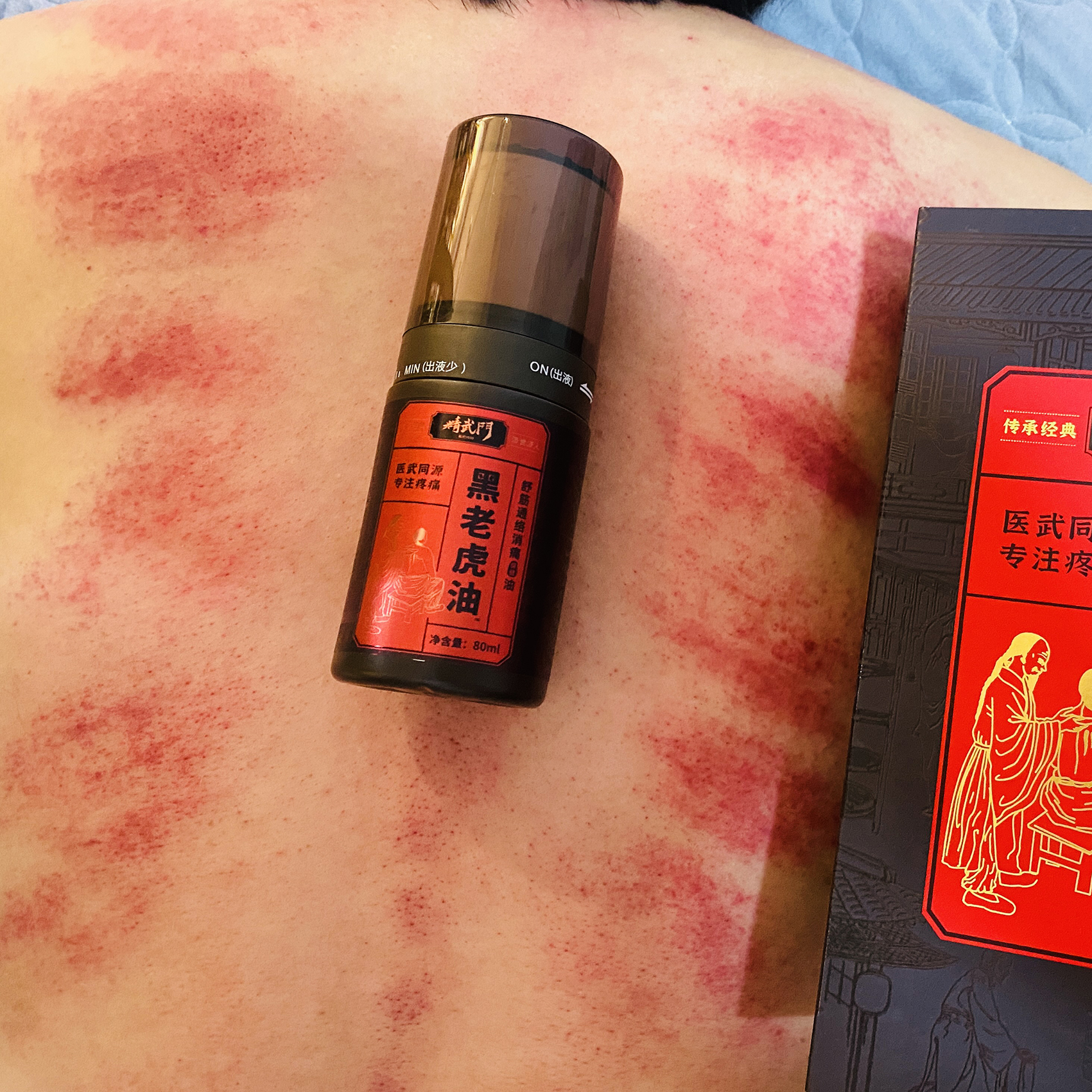精武门黑老虎油使用案例