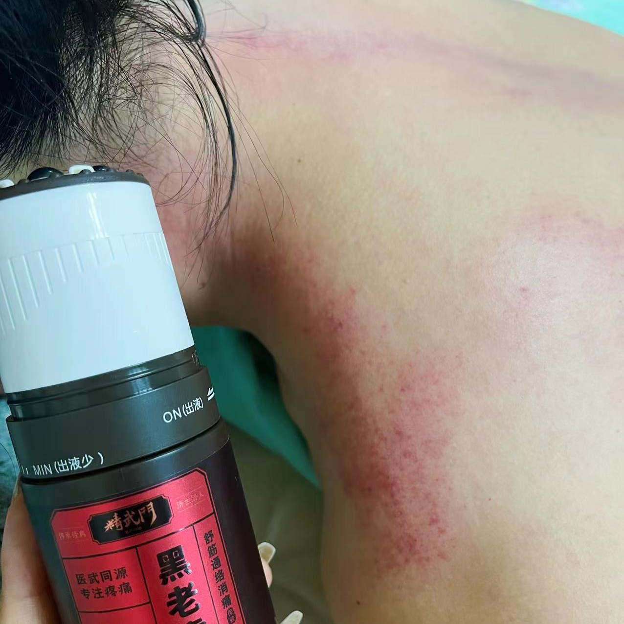 精武门黑老虎油使用案例