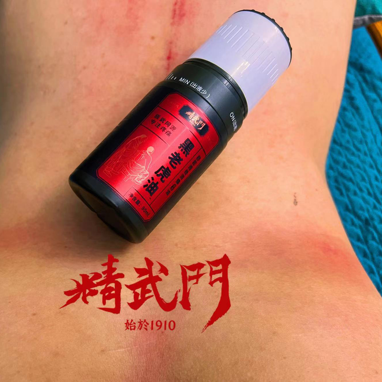 精武门黑老虎油使用案例