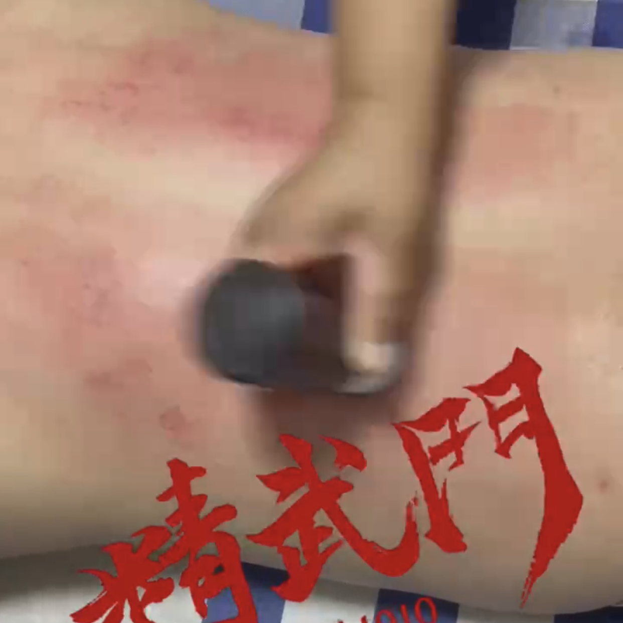 精武门黑老虎油使用案例
