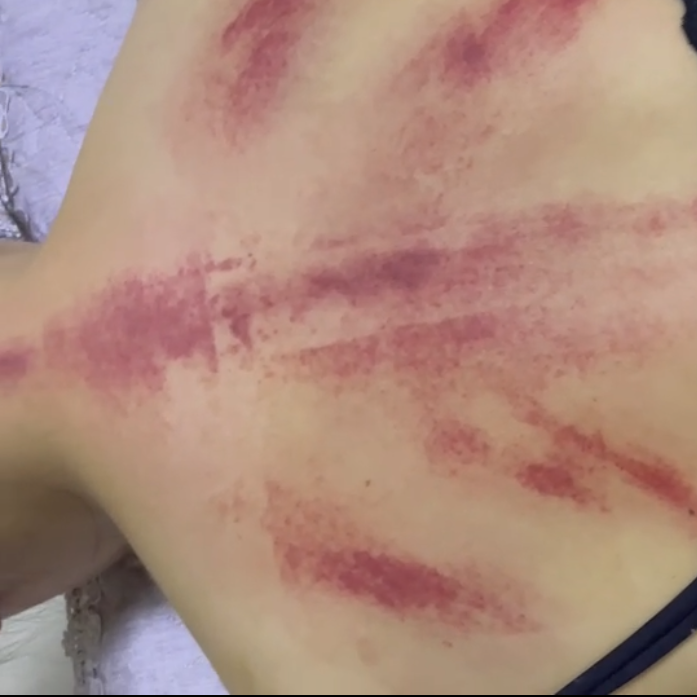 精武门黑老虎油使用案例