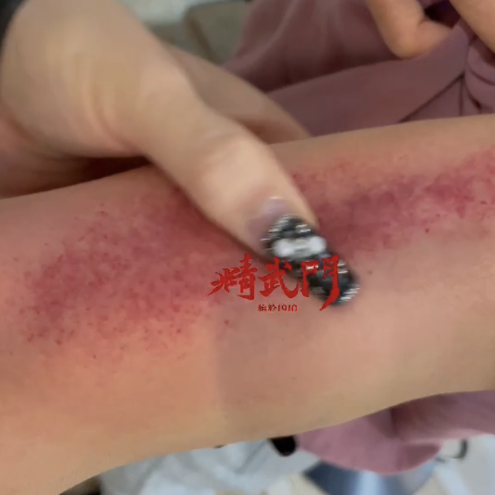精武门黑老虎油使用案例