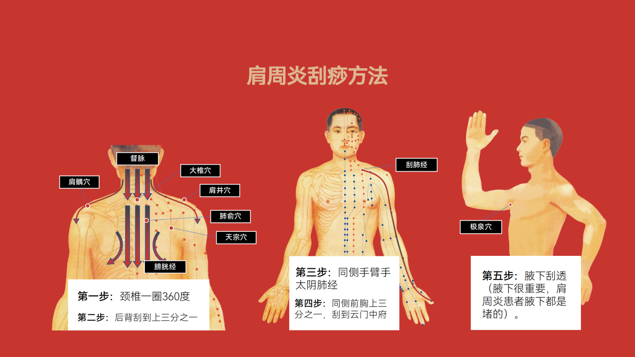 刮痧06.png